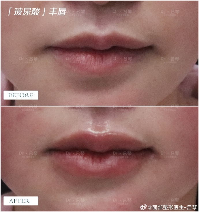 嘴巴嘟嘟版小苹果嘟嘟的小脸嘟嘟的小手嘟嘟的小模样-第2张图片-太平洋在线下载